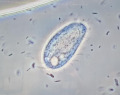 SFN-103950993